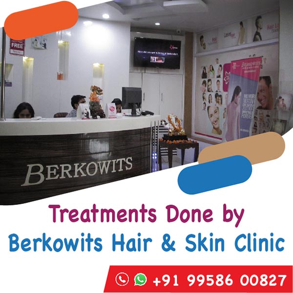 बेरकोविट्स हेयर एंड स्किन क्लिनिक टीम द्वारा किया गया ट्रीटमेंट
