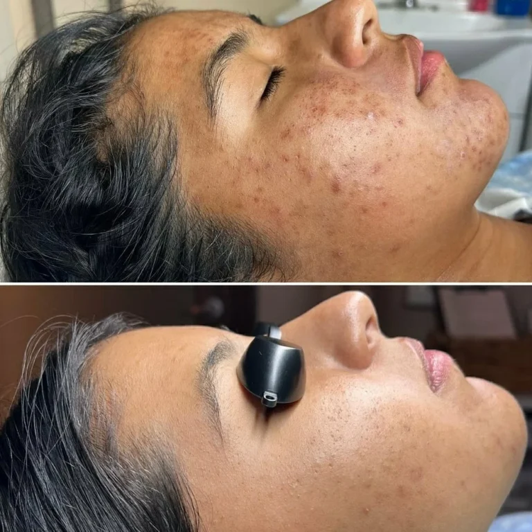 Dikshas Head Masters Makeup Studio Academy Sirsa facial 768x768