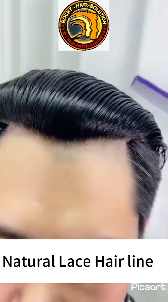1000178572